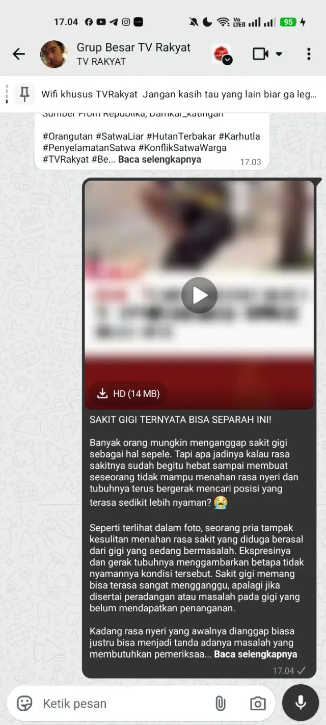seorang pria mengalami sakit gigi — News