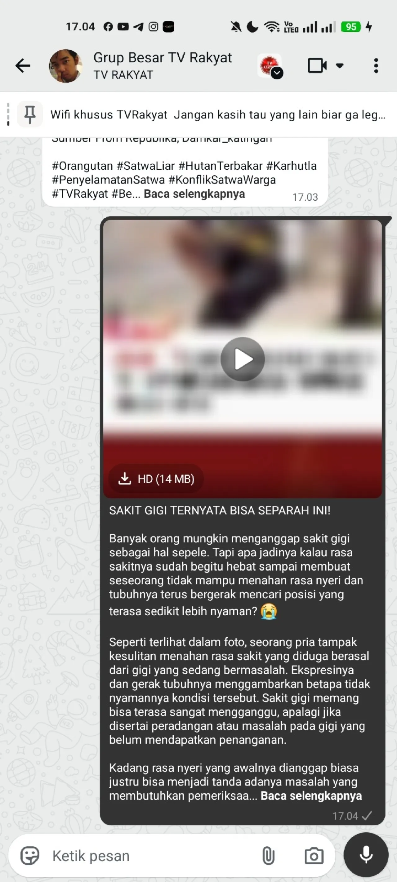 seorang pria mengalami sakit gigi — News